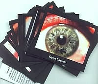 Iridology flashcards